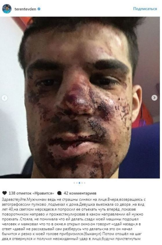 Защитник «Зенита» подробно рассказал об избиении на парковке (фото)